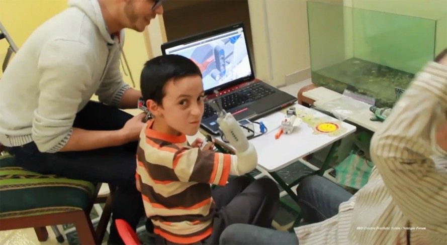 Netexplo-forum-LEGO-prosthetic-5-889x488