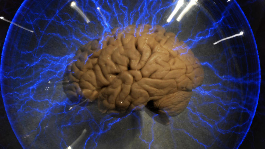 brain02way