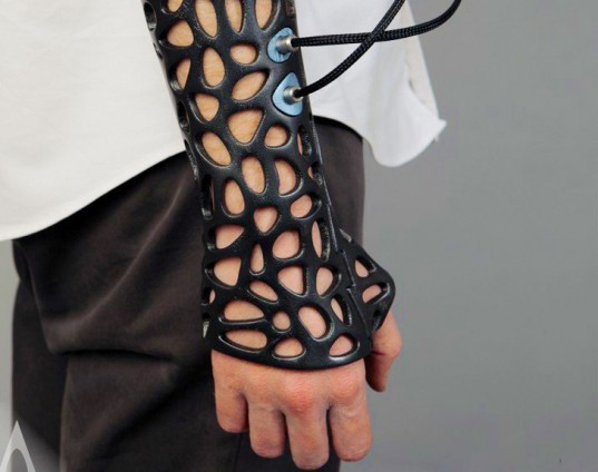 cast