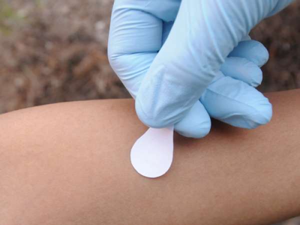 microneedle-patch-2