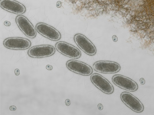 ecoli2
